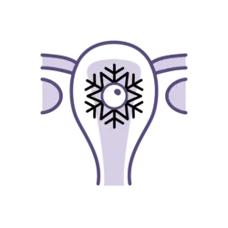 Frozen Embryo Transfer