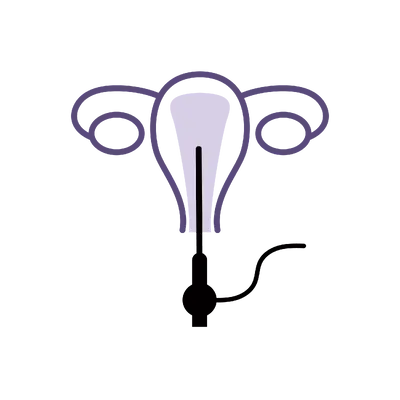 Hysteroscopy in Thailand: Cost, Top Specialists & Hospitals