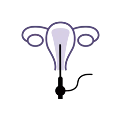 Hysteroscopy