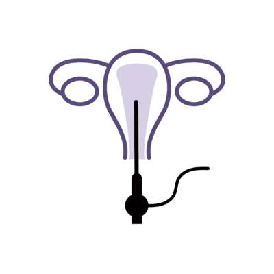 Hysteroscopy