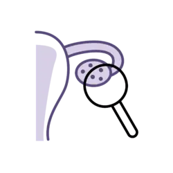 Ovarian Reserve Testing